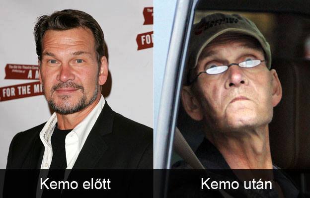 Kemó előtt – Kemó után